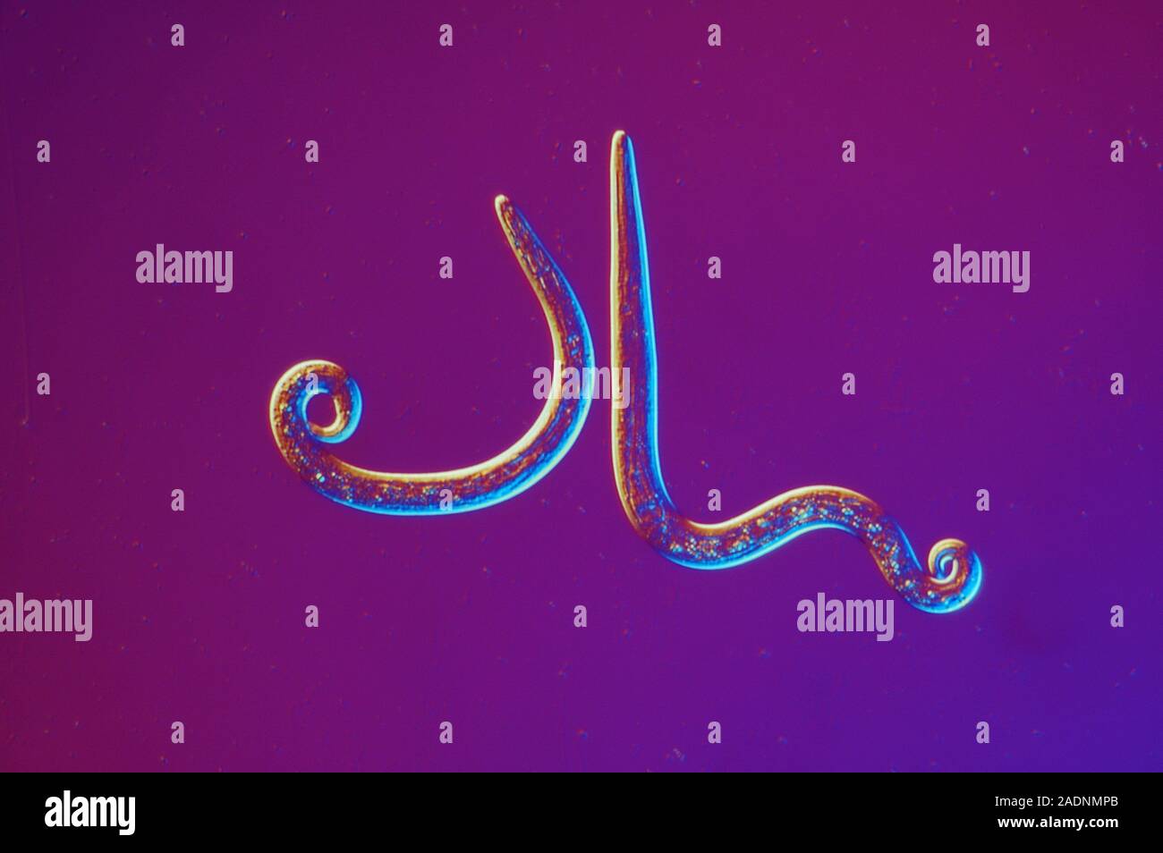 Dog lungworm (Angiostrongylus vasorum) larvae, light micrograph. This