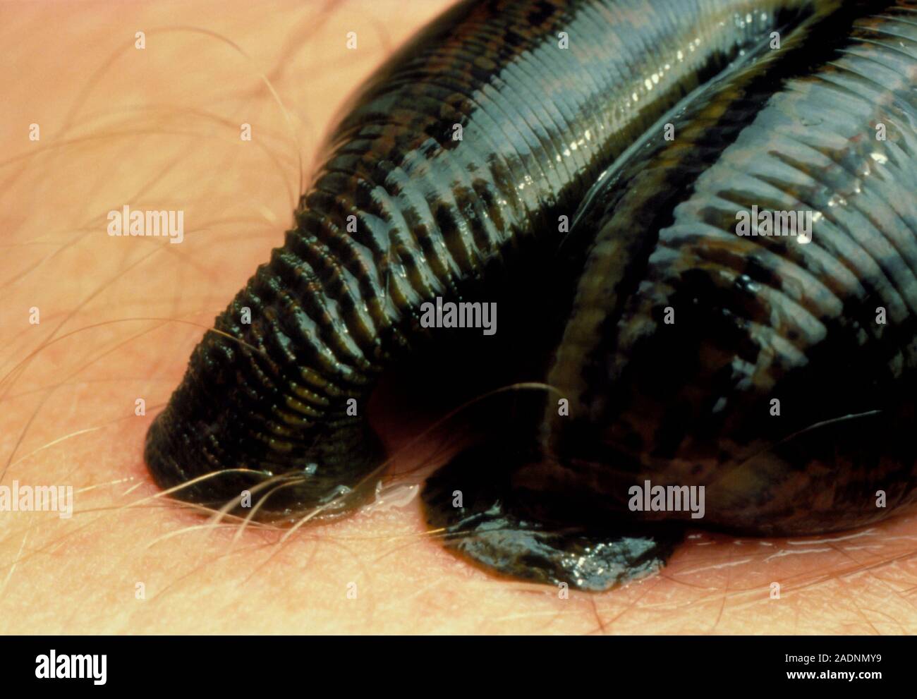 Leech Teeth Human