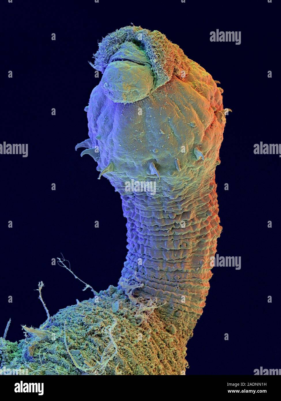 Peanut worm. Coloured scanning electron micrograph (SEM) of an unidentified peanut worm (phylum