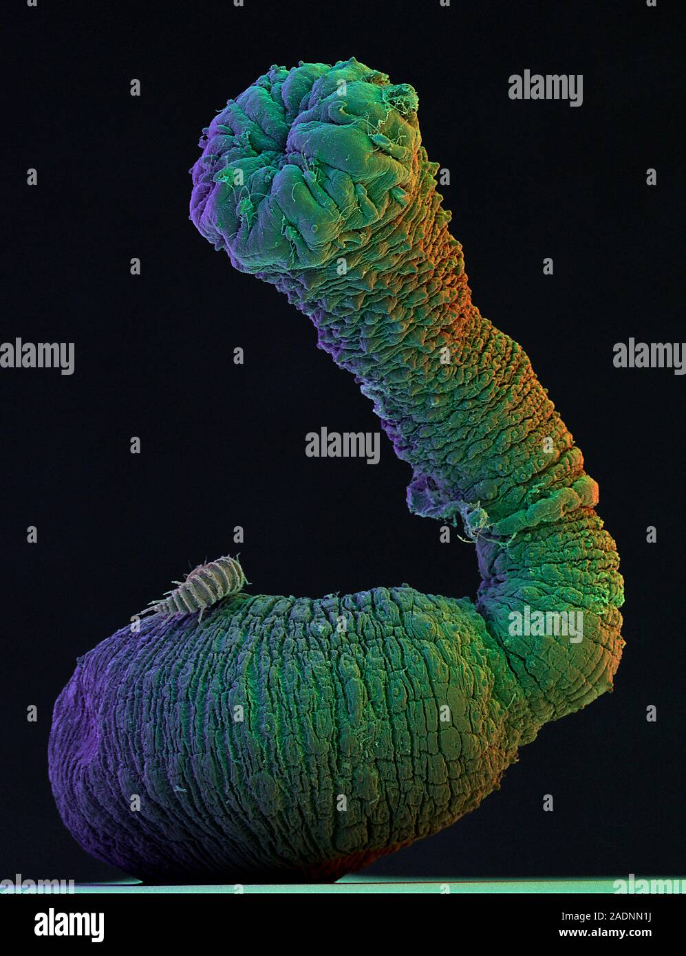 Peanut worm. Coloured Scanning Electron Micrograph (SEM) of a sipunculid or peanut" worm
