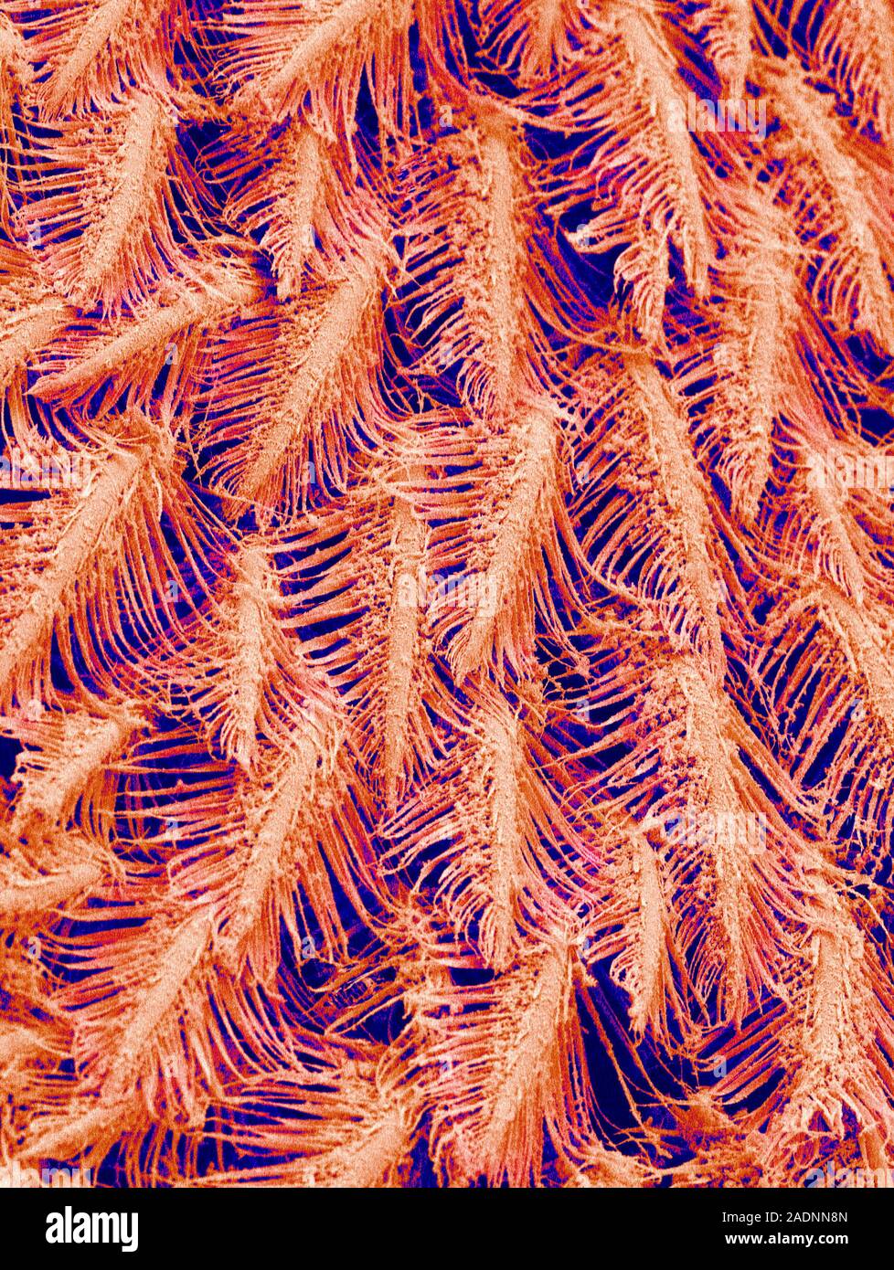 Crab filterfeeding structures. Coloured scanning electron micrograph