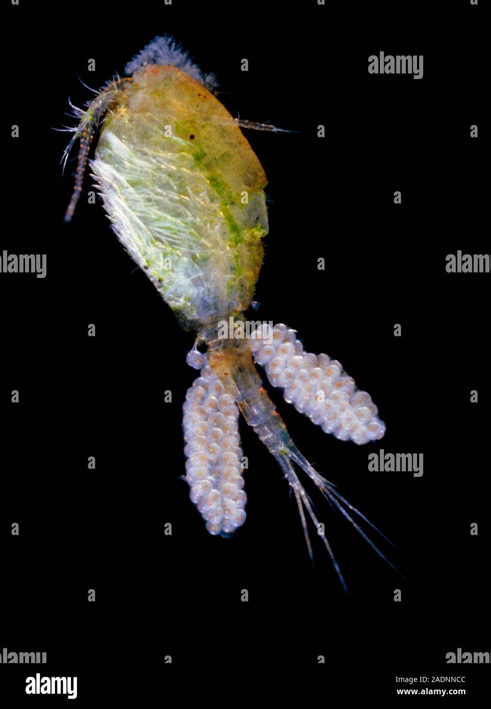 Light micrograph of the tiny freshwater crustacean, Cyclops sp. . This ...