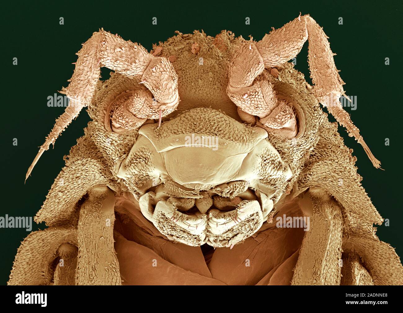 Woodlouse head, coloured scanning electron micrograph (SEM). This view ...