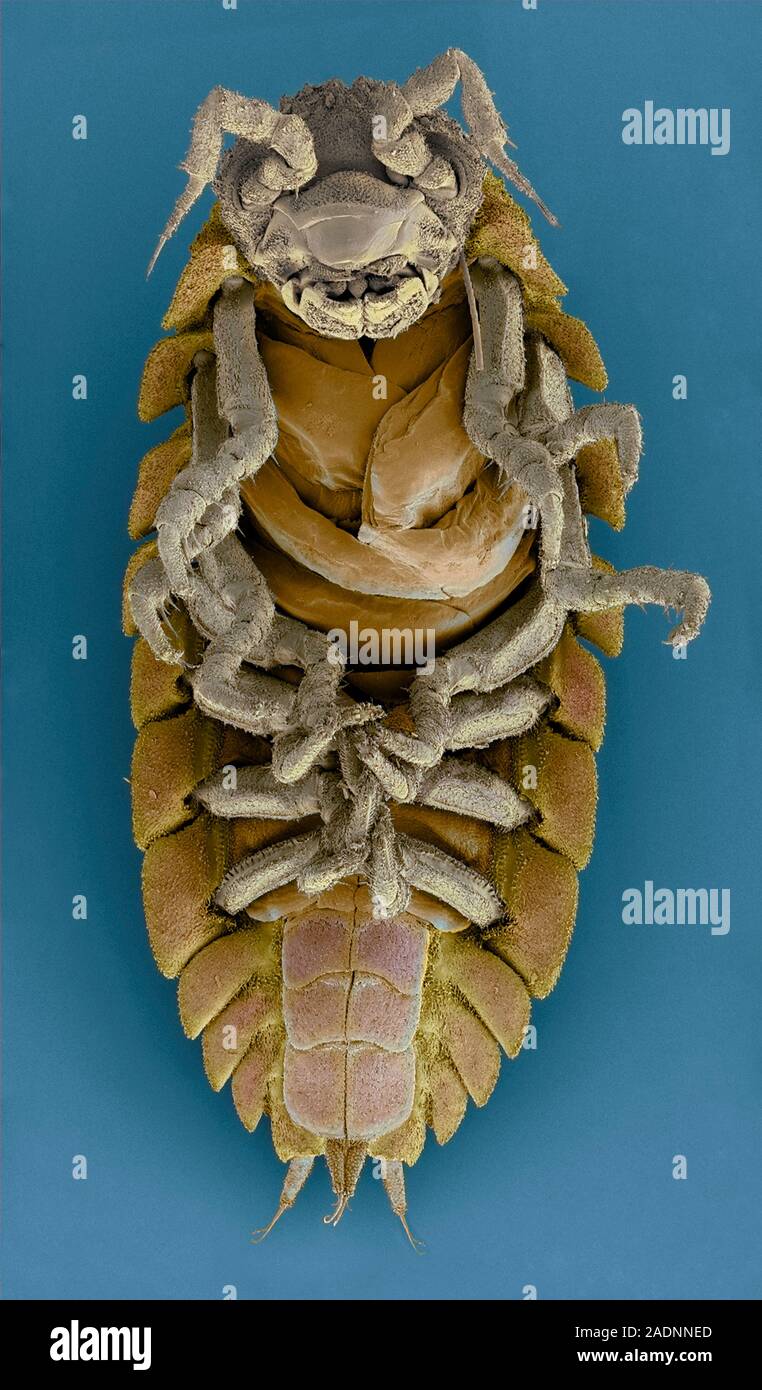 Woodlouse. Coloured scanning electron micrograph (SEM) of the underside