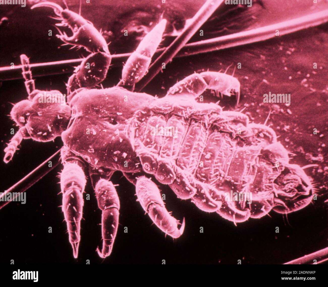 False-colour scanning electron micrograph of the blood sucking human ...