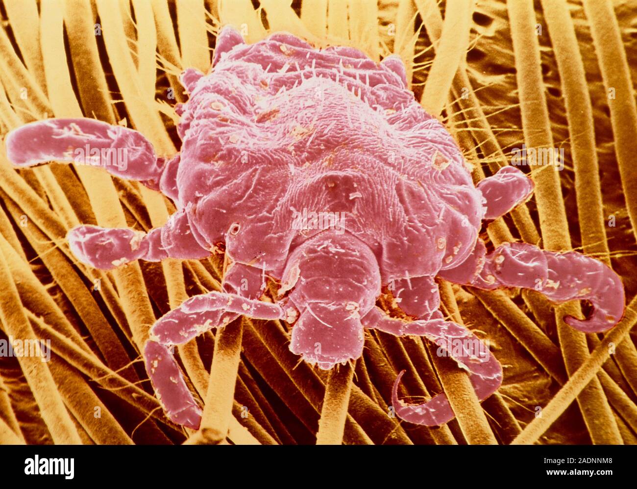 Scanning electron micrograph (SEM) of the pubic louse, Phthirus pubis
