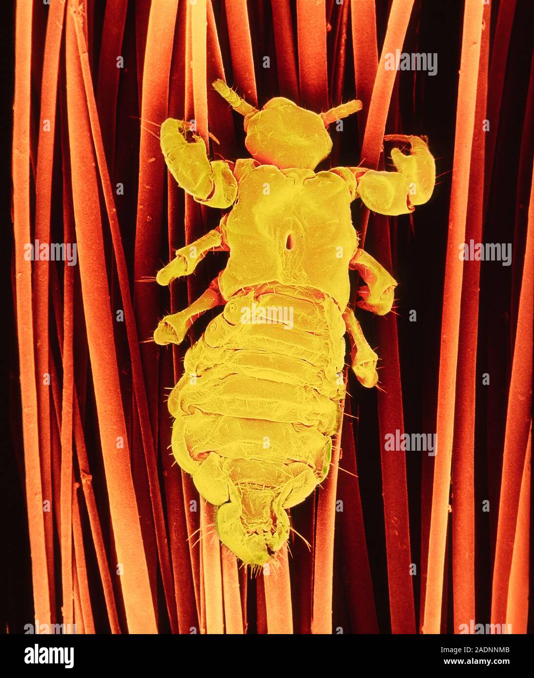 False-colour scanning electron micrograph (SEM) of a human head louse ...