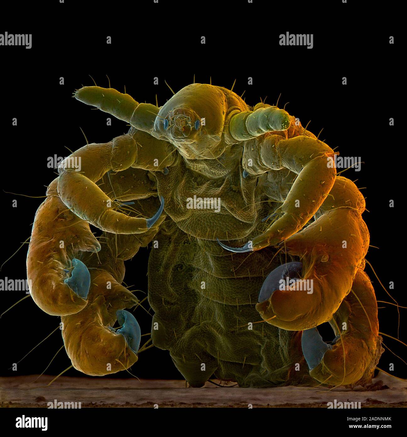 Crab louse. Coloured Scanning Electron Micrograph (SEM) of the crab