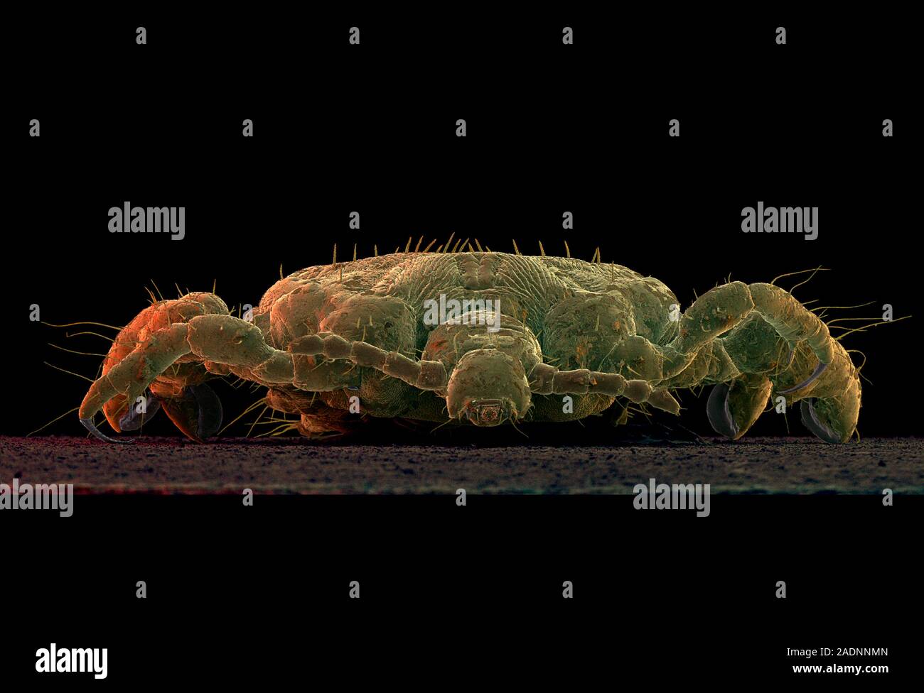 Crab louse. Coloured Scanning Electron Micrograph (SEM) of the crab