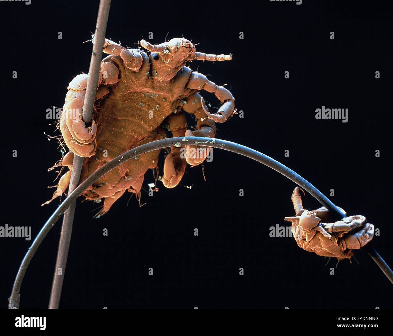 Pubic lice. Coloured Scanning Electron Micrograph (SEM) of two pubic