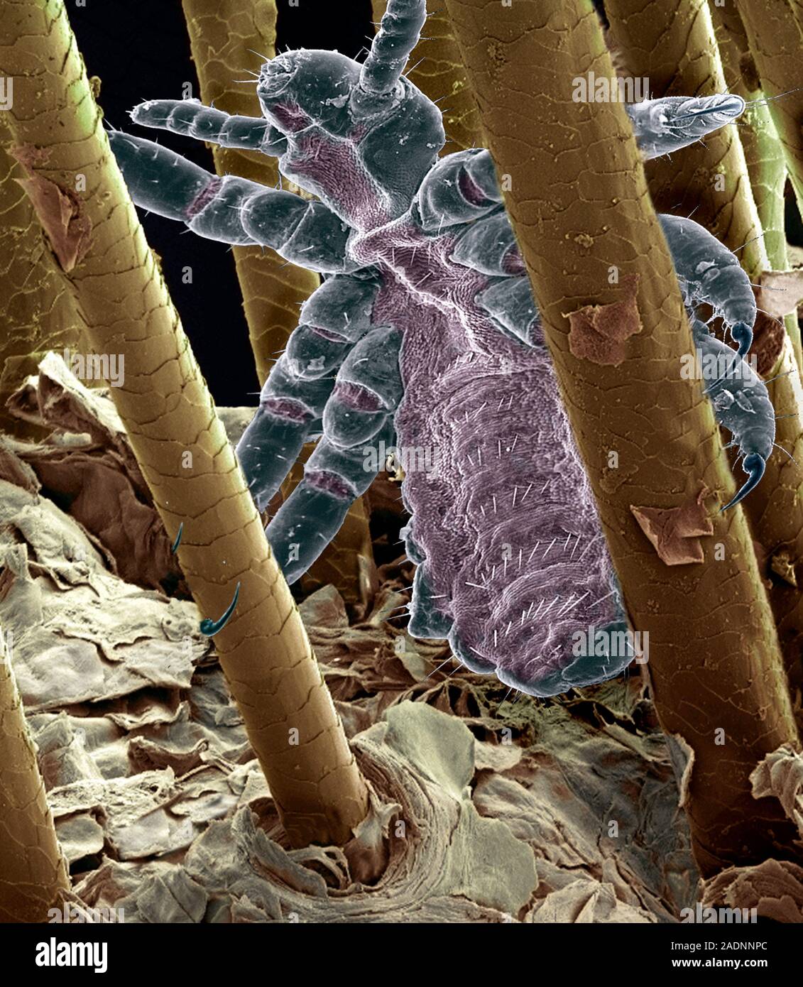 Head louse. Coloured scanning electron micrograph (SEM) of head louse ...