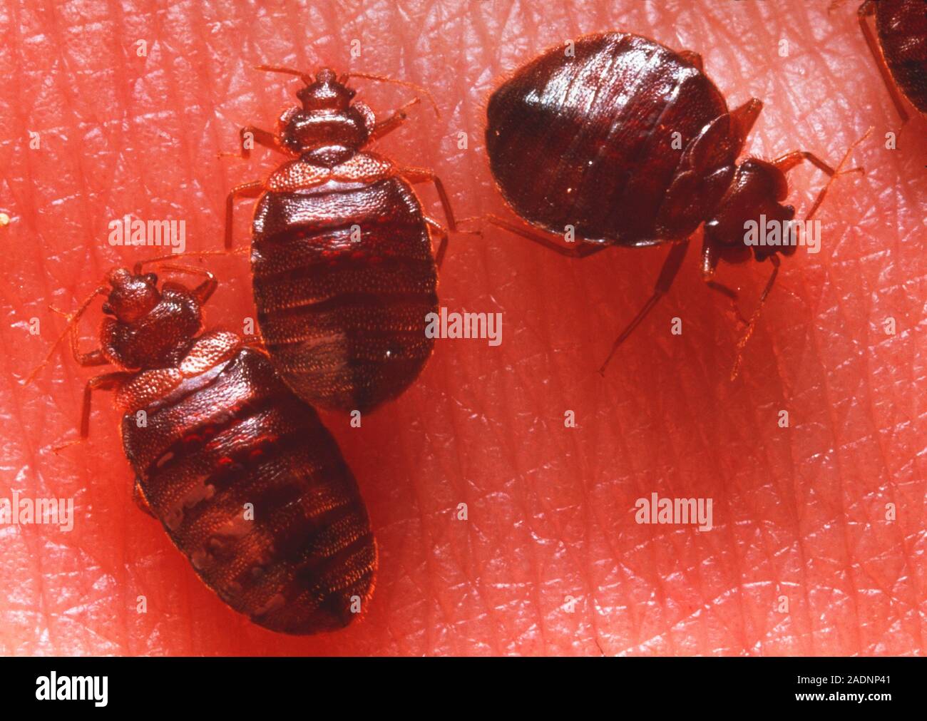 Bedbugs. Macrophotograph of bedbugs (Cimex lectularius) on human skin