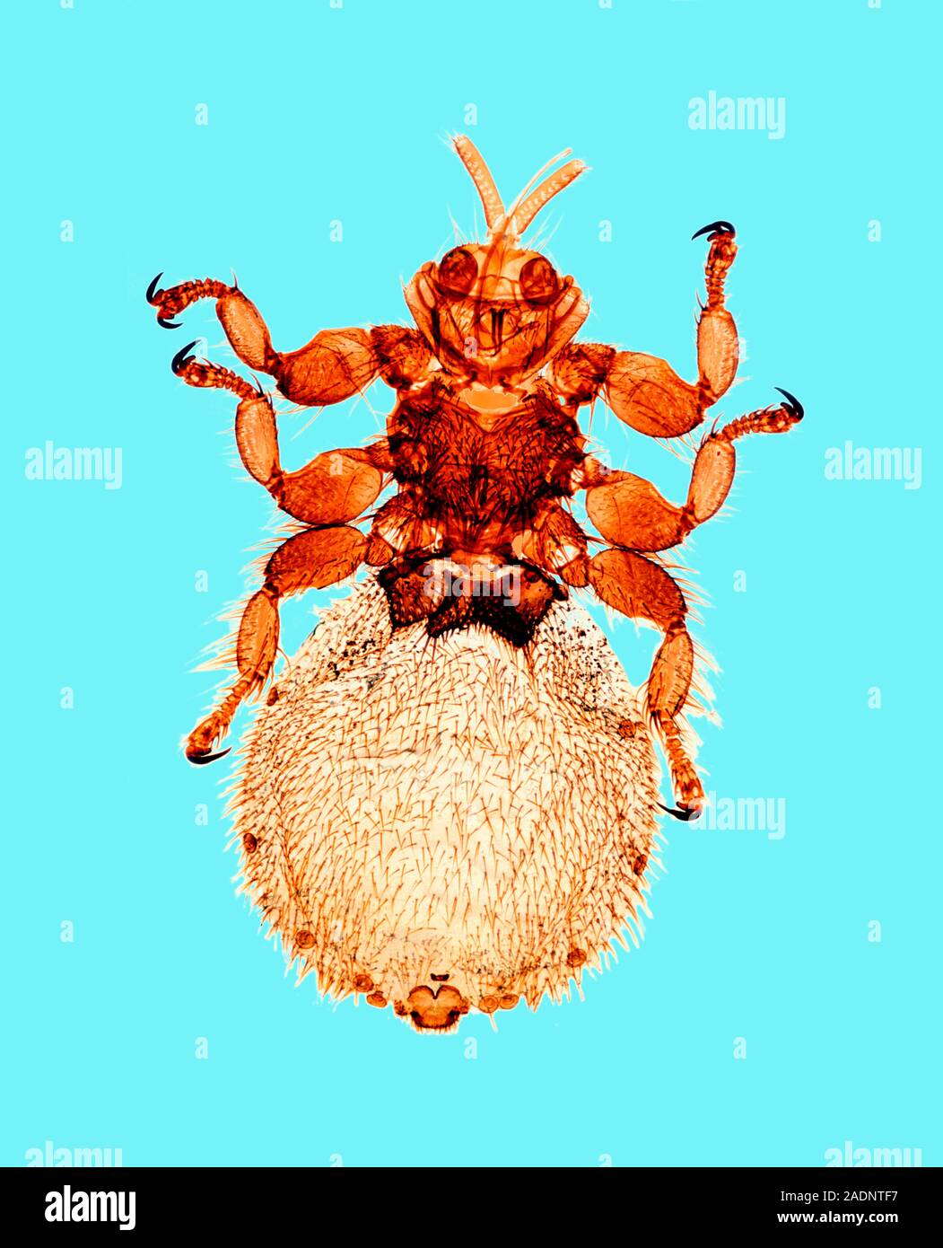 Sheep ked (Melophagus ovinus), light micrograph. This wingless, blood-sucking fly is an ectoparasite of sheep. The hooks on the ends of its legs help Stock Photo