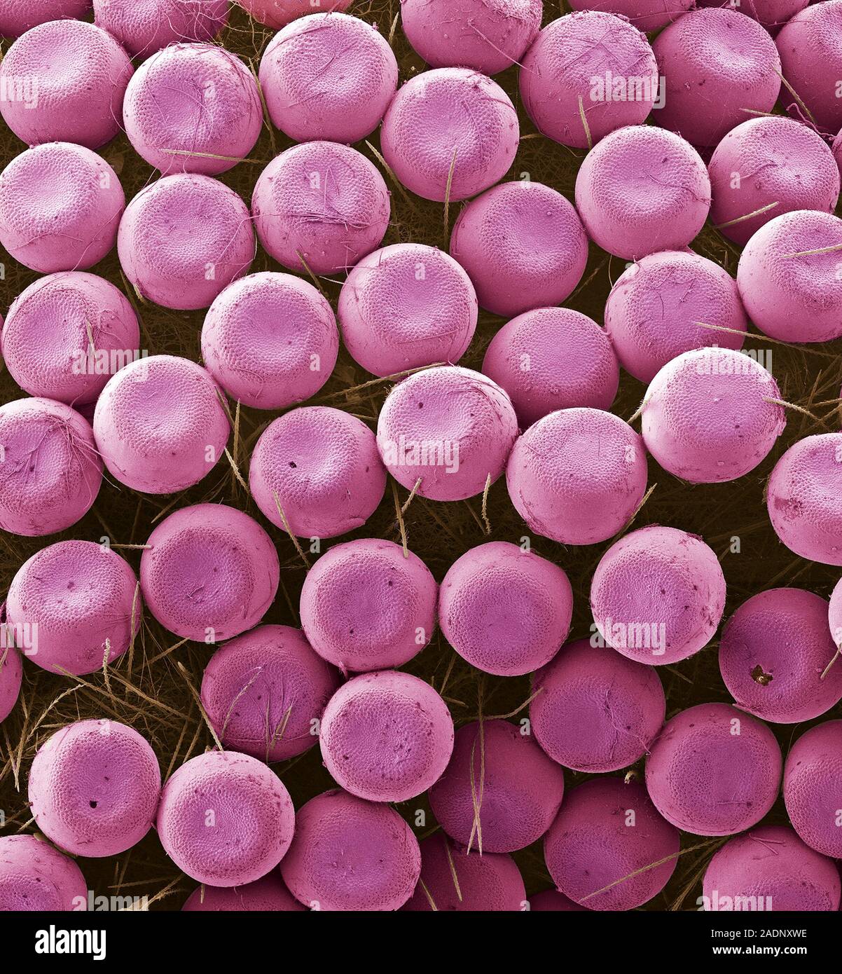 Butterfly eggs. Coloured scanning electron micrograph (SEM) of the eggs