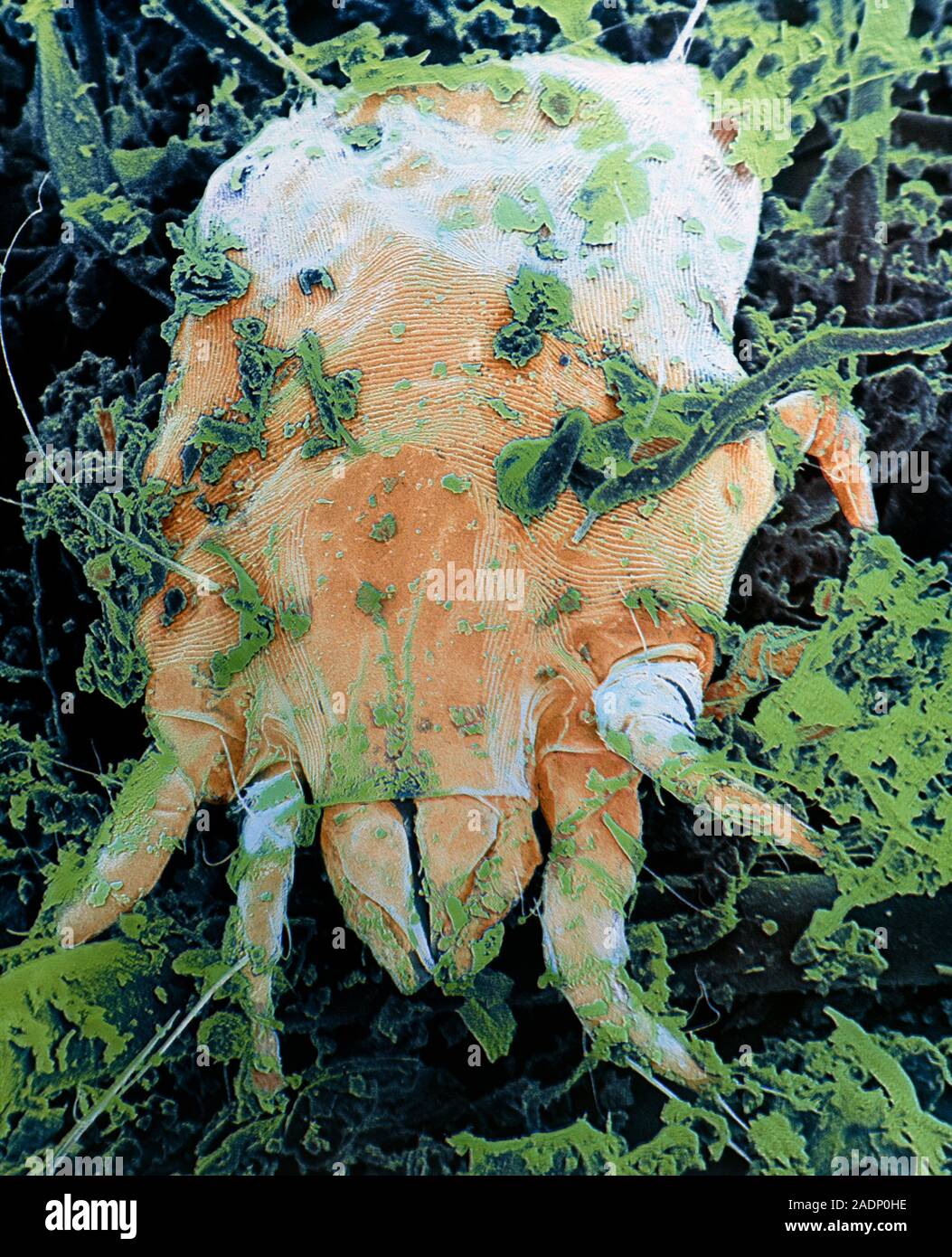 False-colour scanning electron micrograph (SEM) of a sample of ...