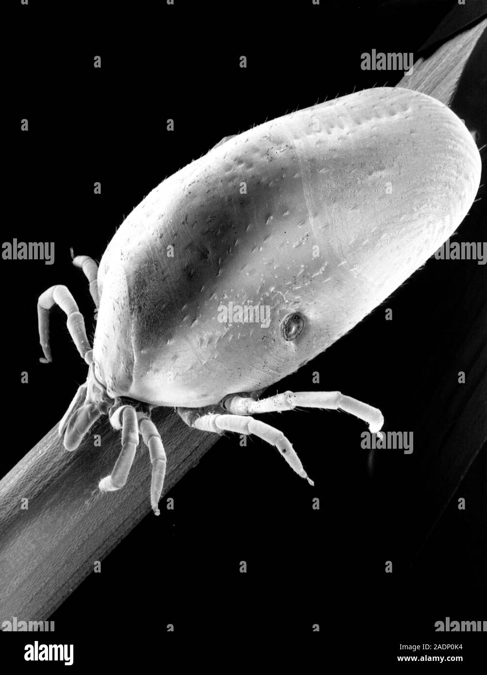 Lyme disease tick. Scanning electron micrograph of an female