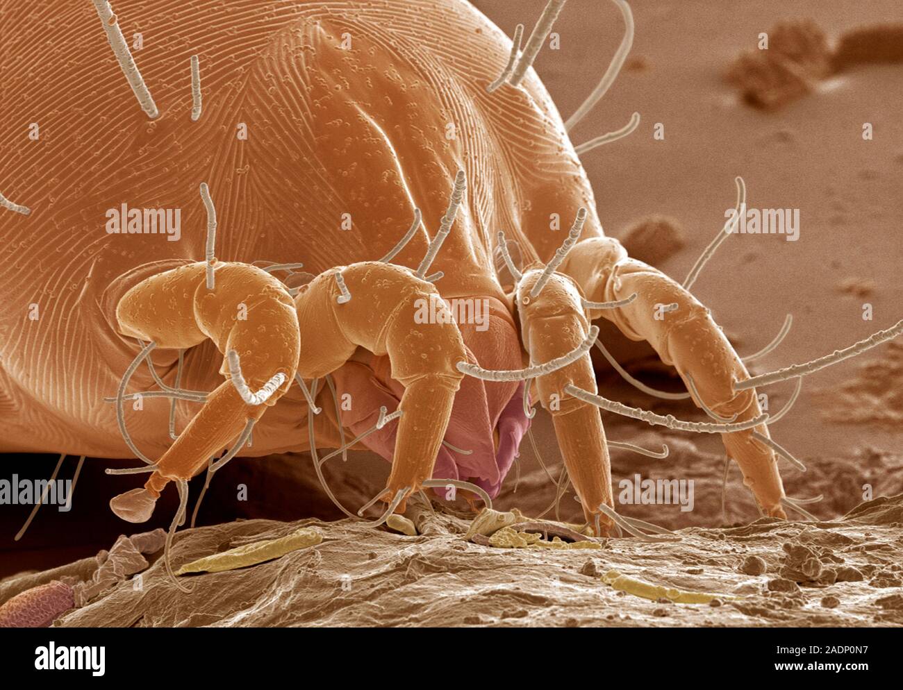 микроскопические клещи. клещ dermatophagoides pteronyssinus. клещ dermatophagoides farinae. Dermatophagoides pteronyssinus биология. Pteronyssinus.