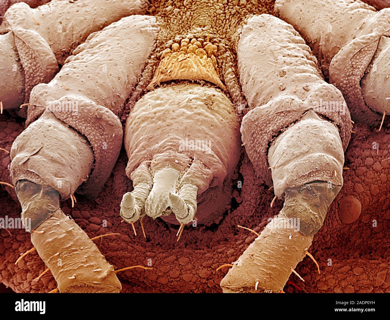 Sheep Tick Coloured Scanning Electron Micrograph SEM Of The 