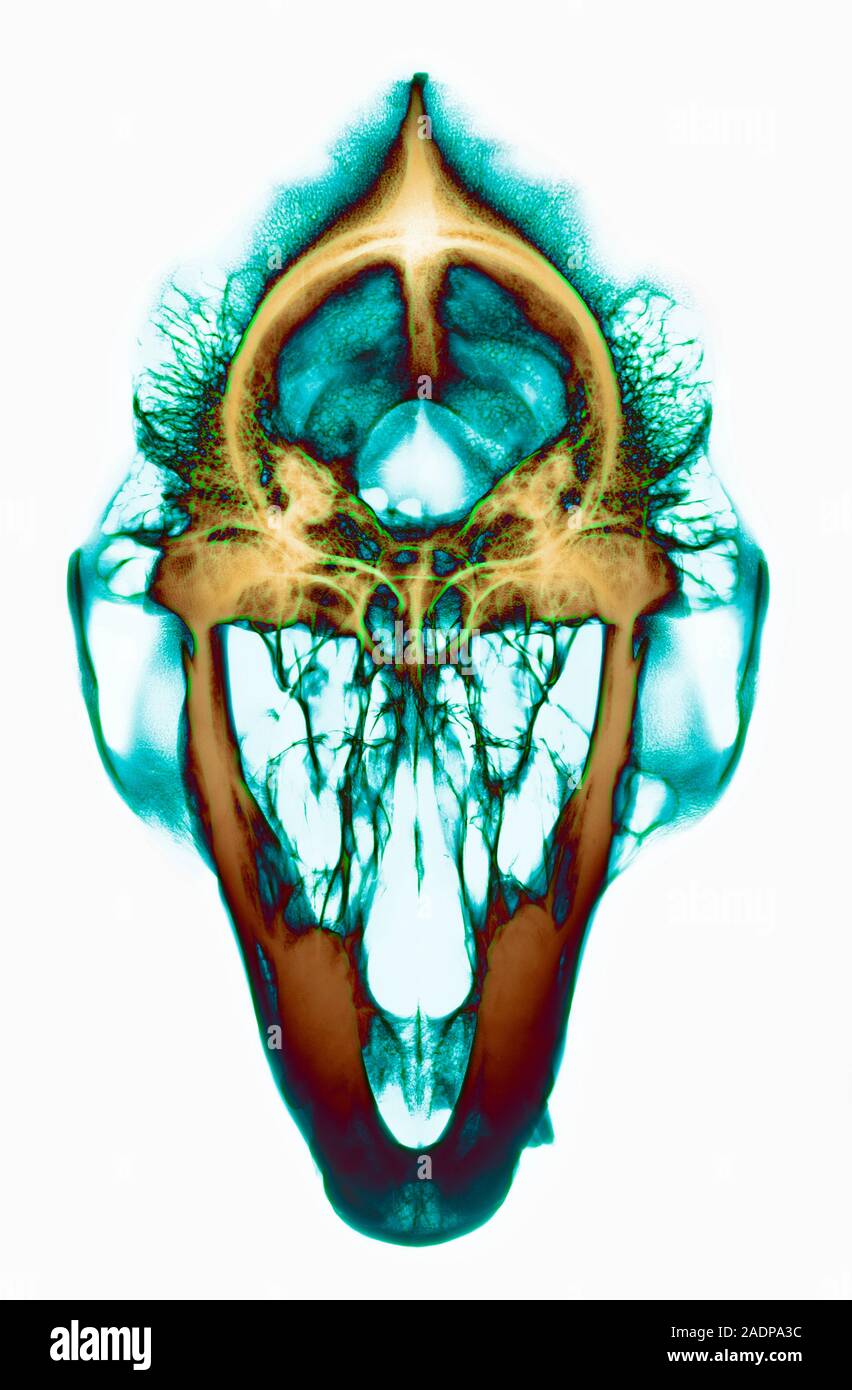 Gorilla skull. Coloured Xray of a front view of the skull of a male