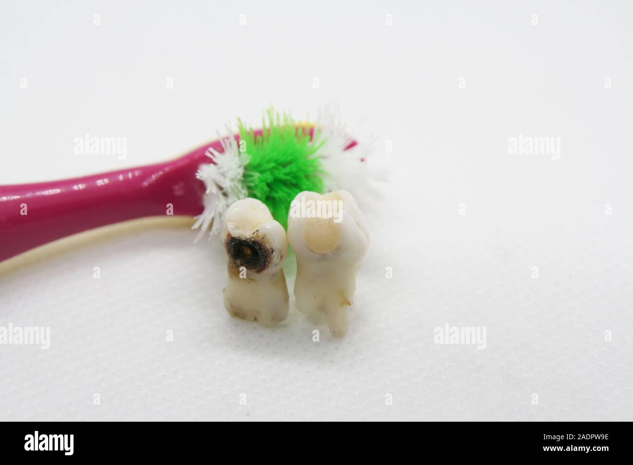 Bad tooth and toothbrush. Dental hygiene. Rotten tooth and toothbrush. Extracted tooth. Stock Photo