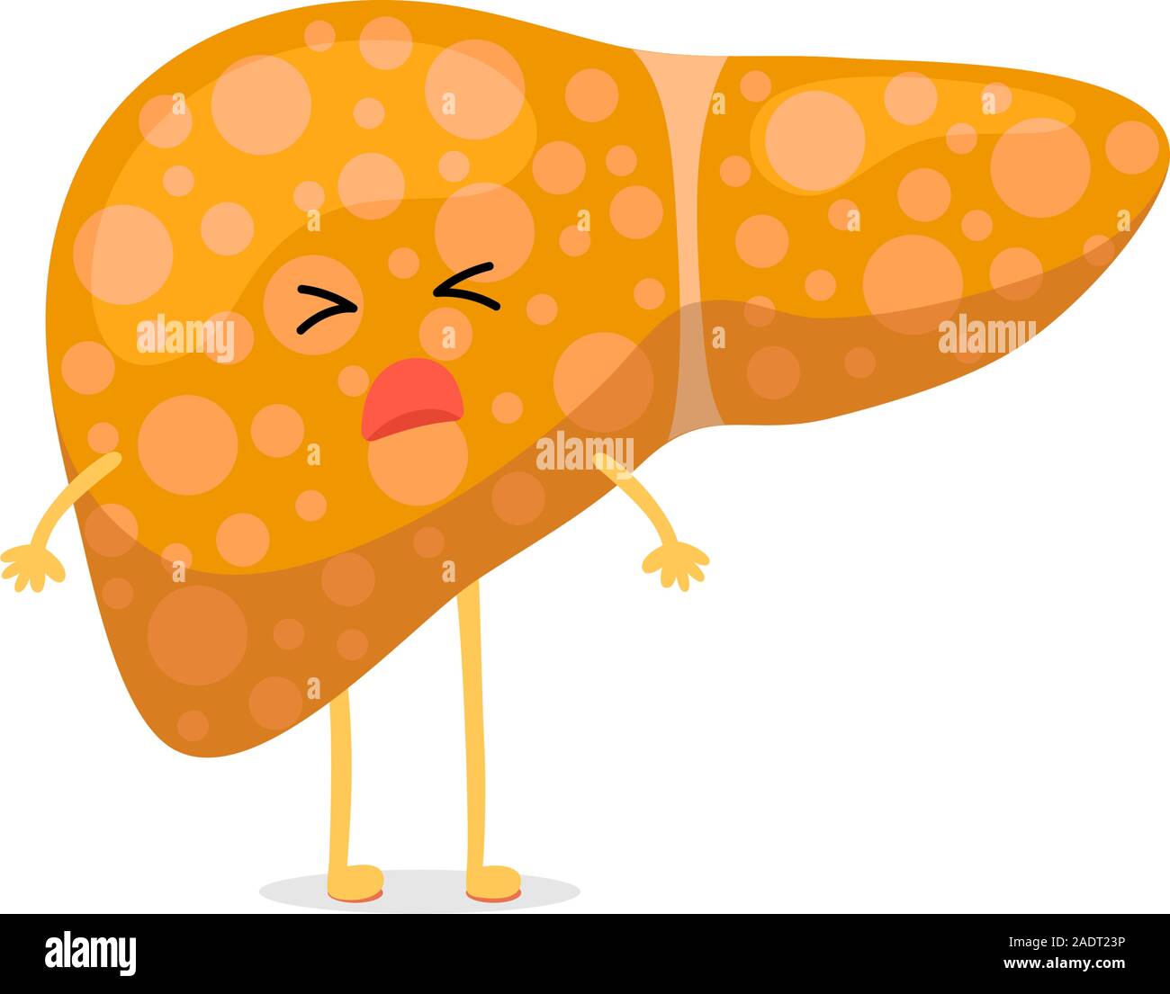 Sick unhealthy cartoon liver character suffers from jaundice or hepatitis and suffering pain. Human exocrine gland organ destruction concept. Vector hepatic illustration Stock Vector
