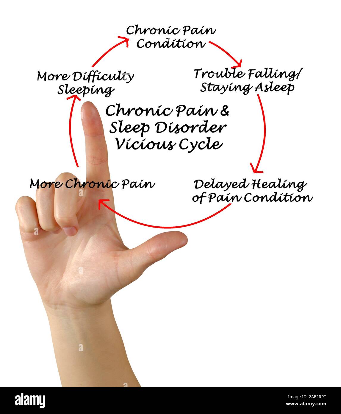Chronic Pain & Sleep Disorder Vicious Cycle Stock Photo - Alamy