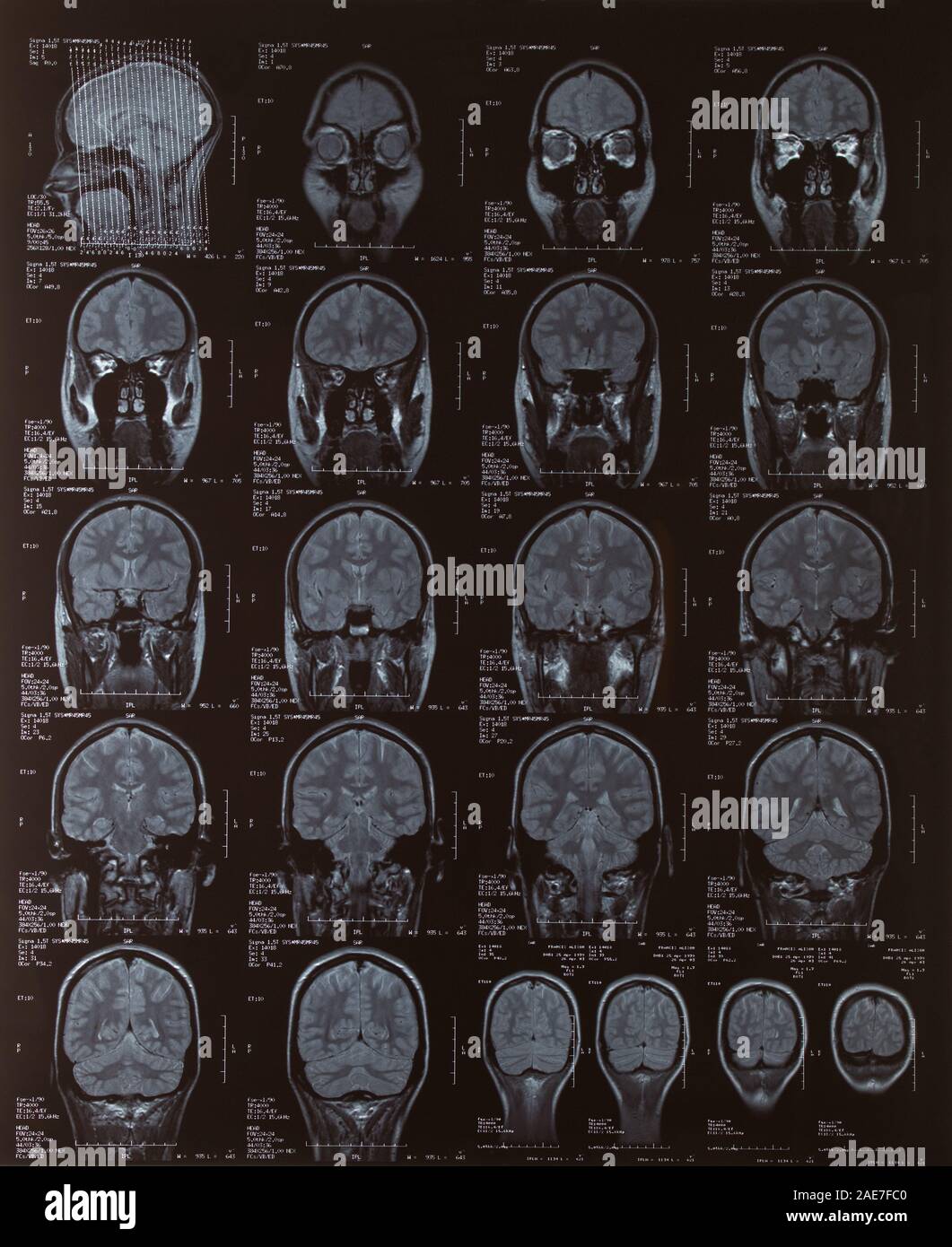 MRI Scan of the female brain Stock Photo