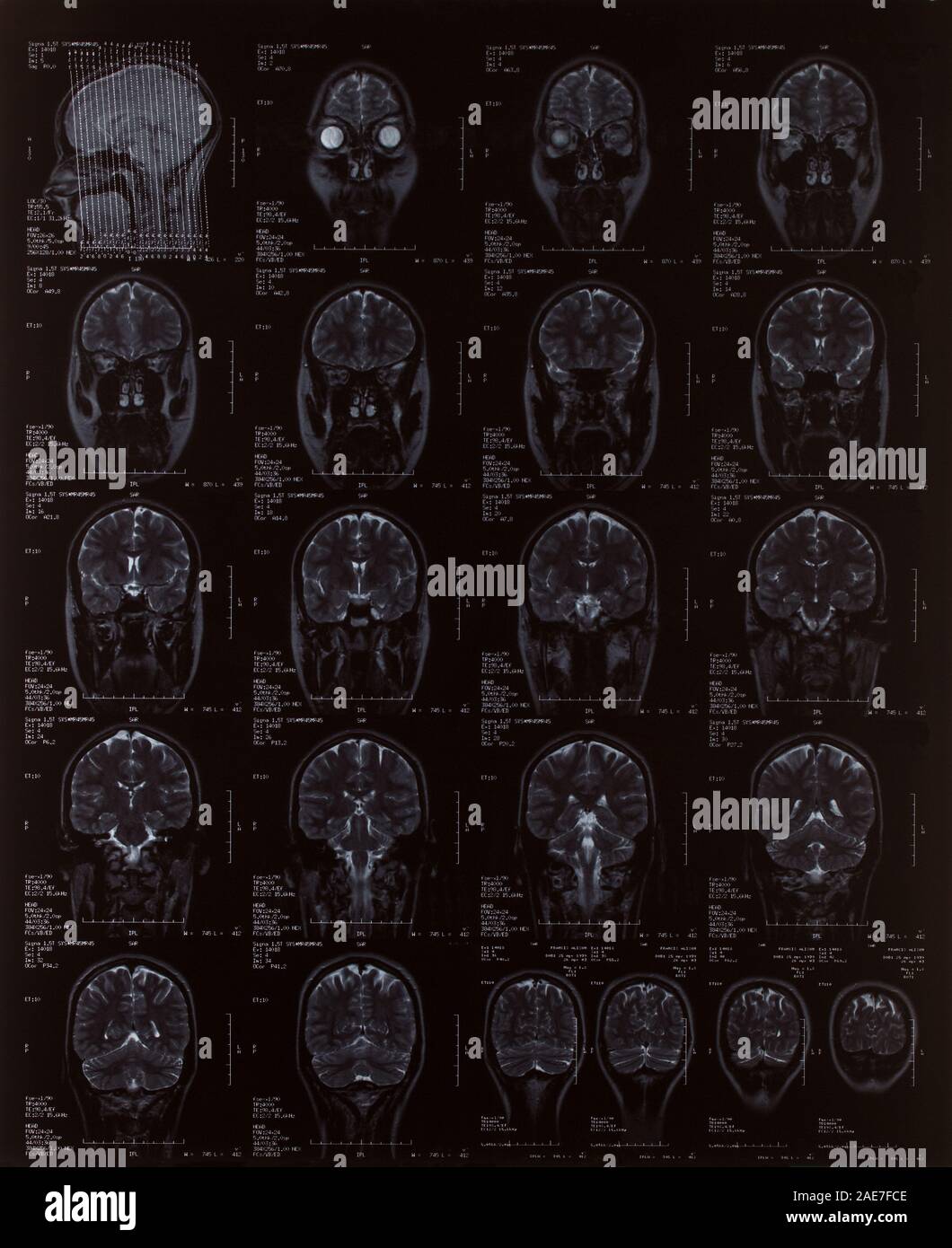 MRI Scan - Sequence of vertical sections of a female human brain Stock Photo