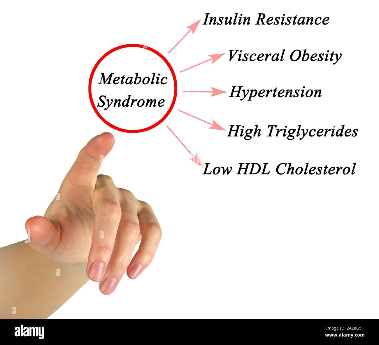 Symptoms of Metabolic Syndrome Stock Photo