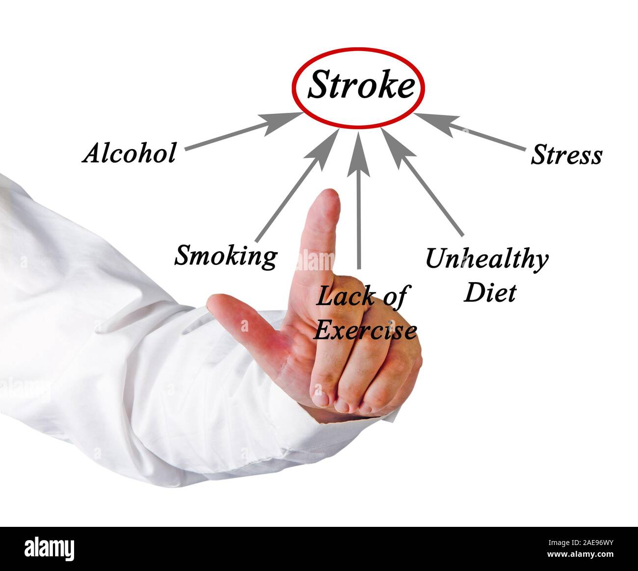 Stroke Causes