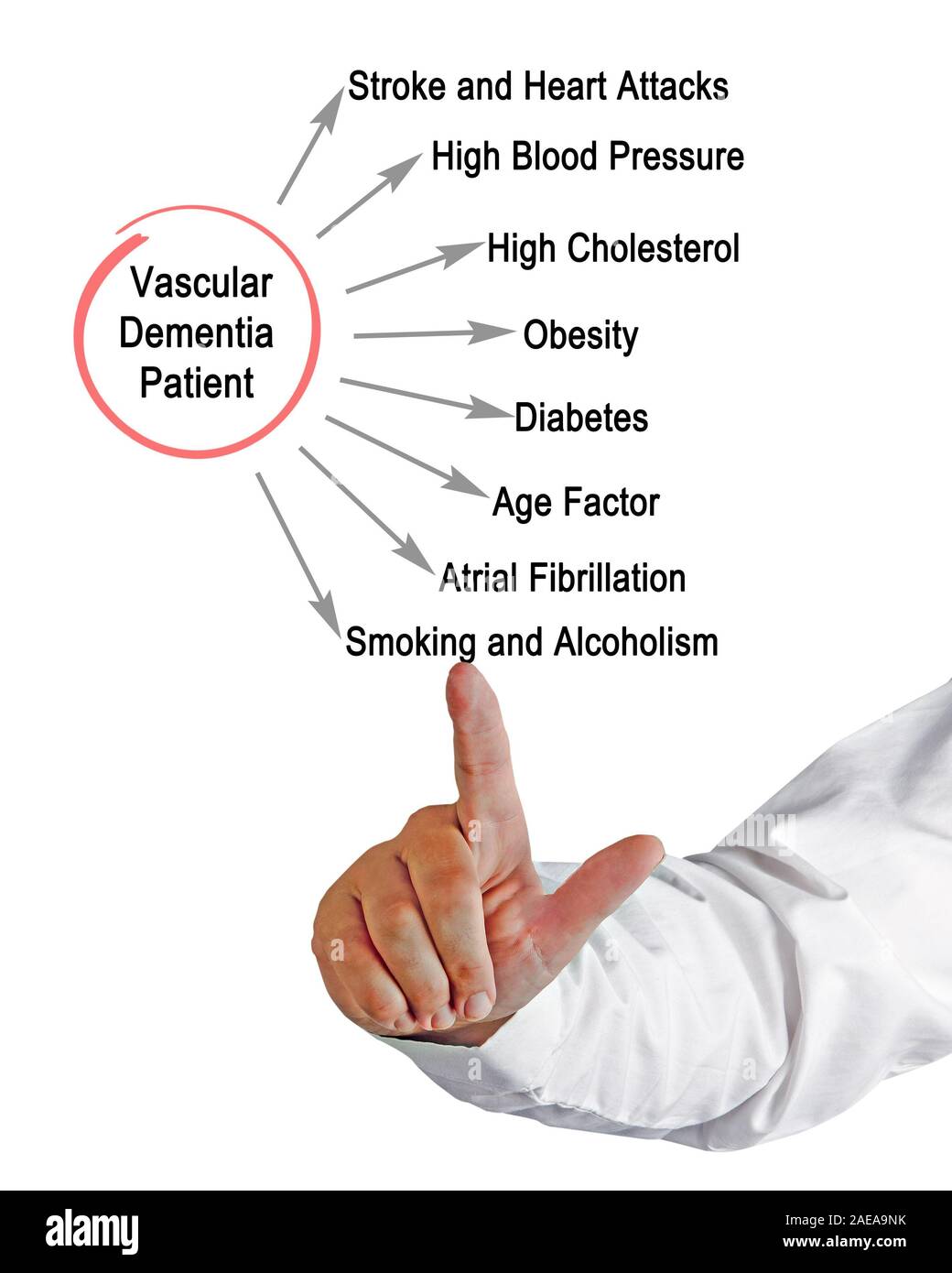 Vascular dementia hires stock photography and images Alamy