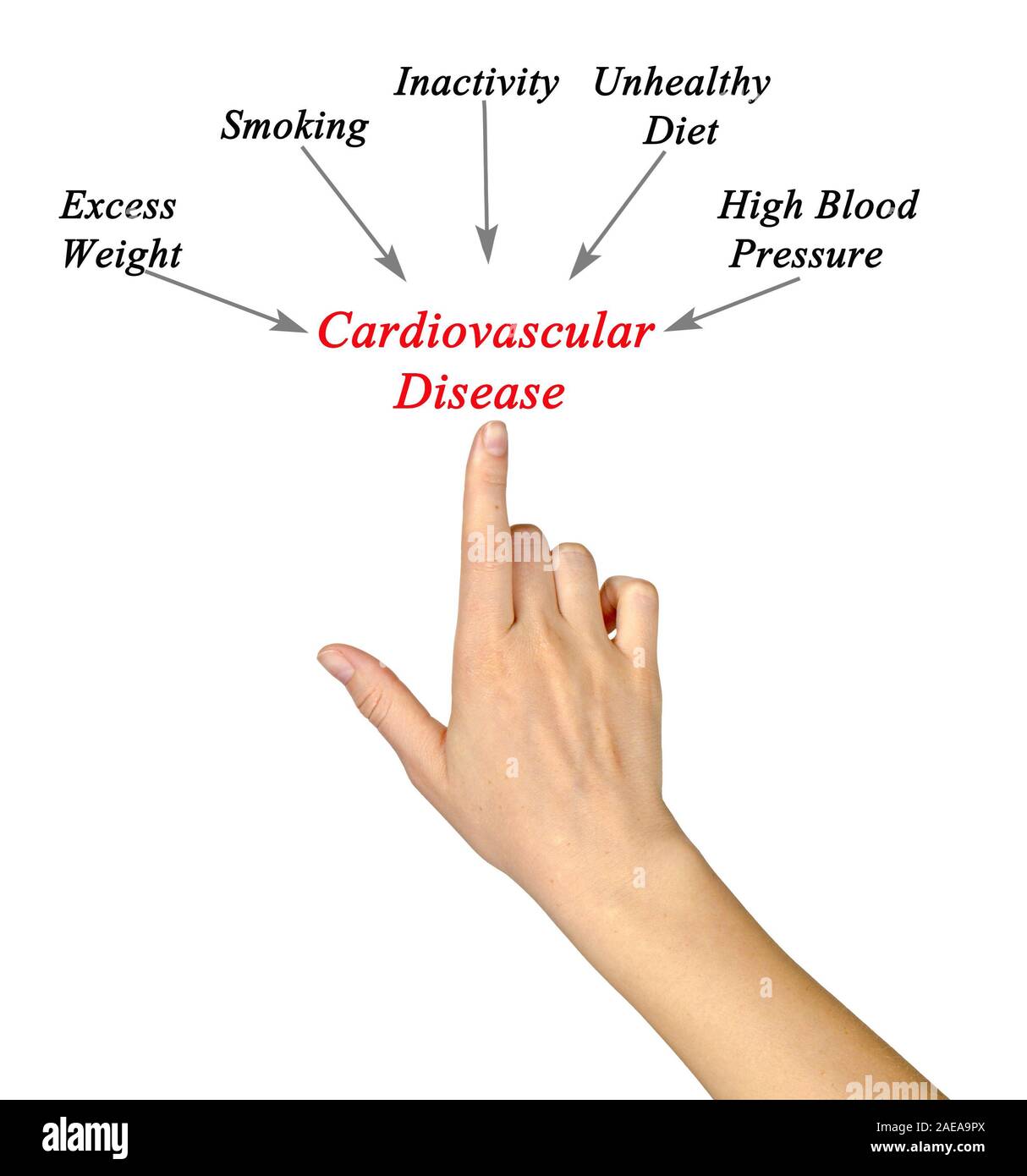 Causes to cardiovascular Disease Stock Photo