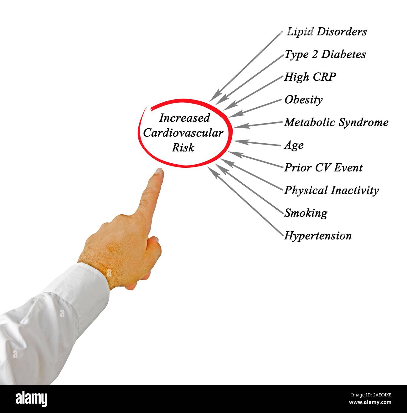 Cv disease hi-res stock photography and images - Alamy