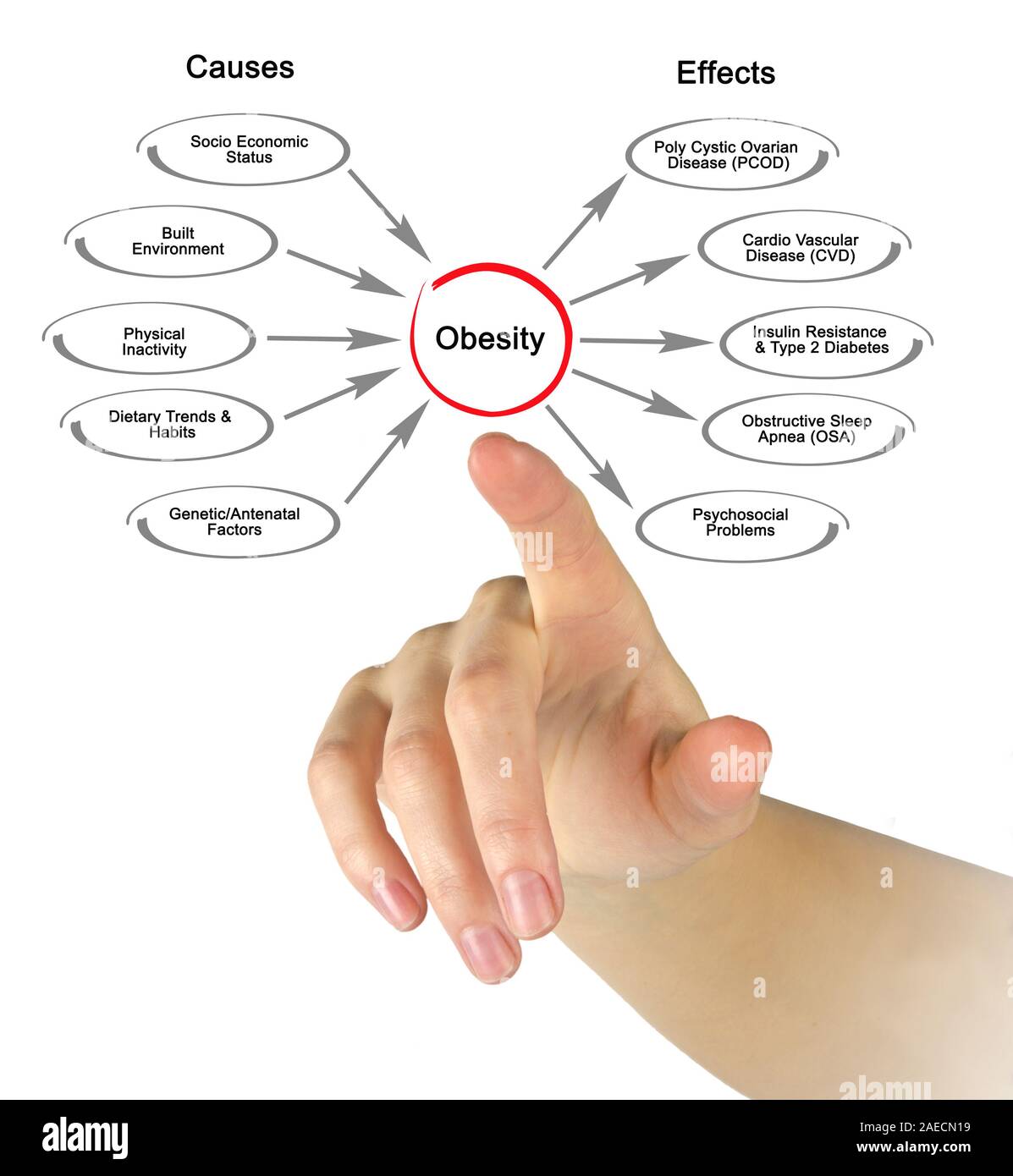 Obesity Causes And Effects Stock Photo Alamy