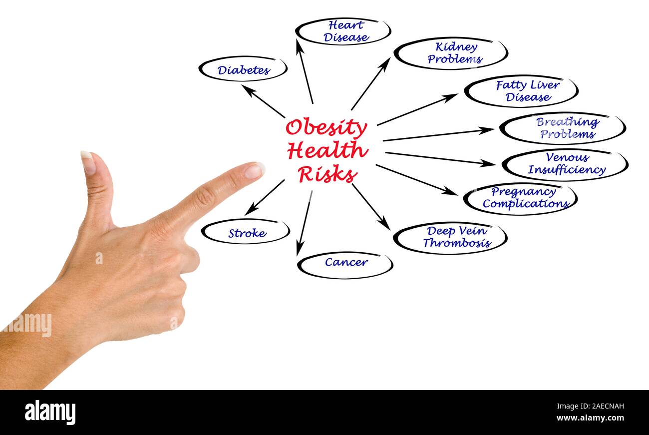 Obesity Health Risks Stock Photo - Alamy