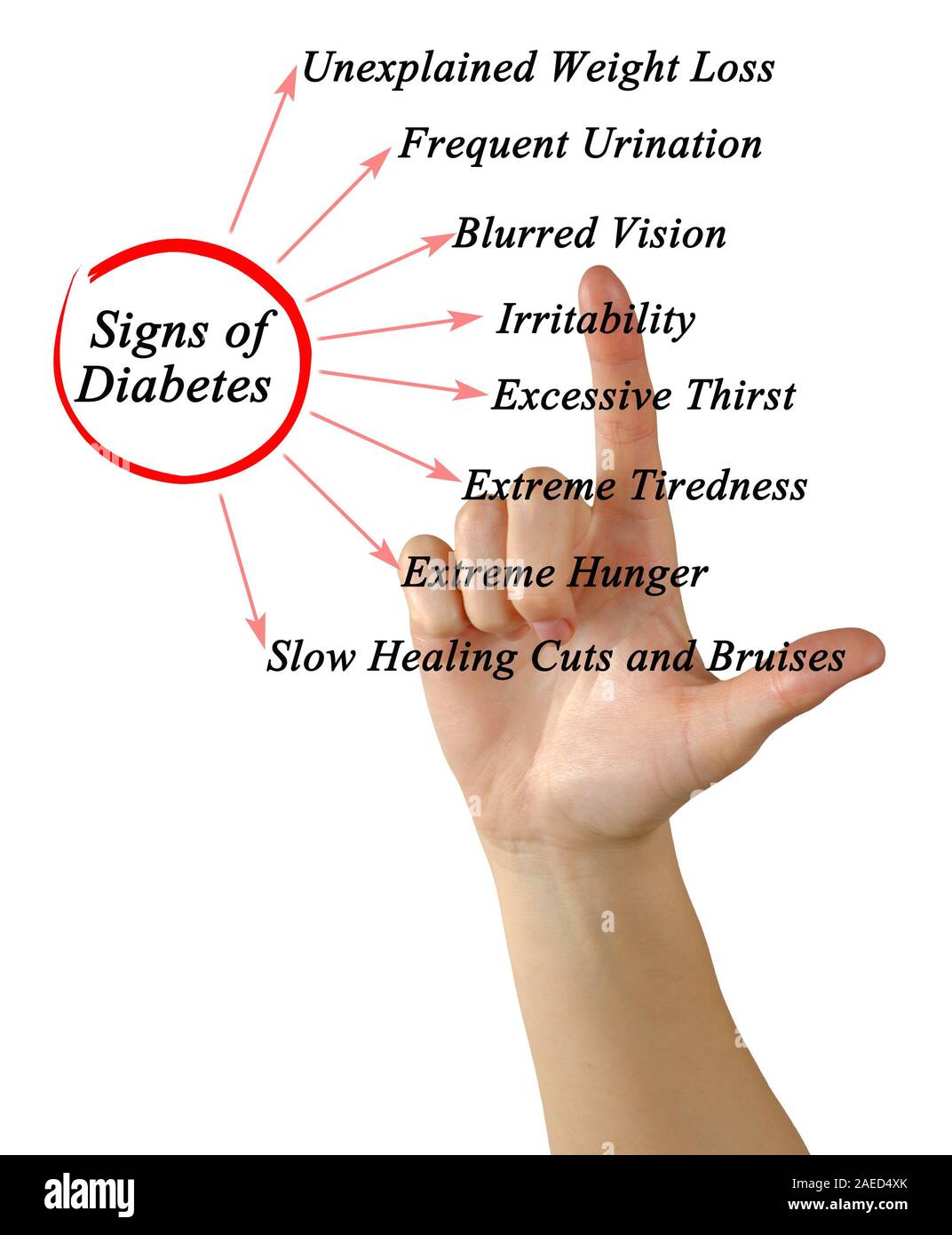 Signs Of Diabetes Stock Photo Alamy