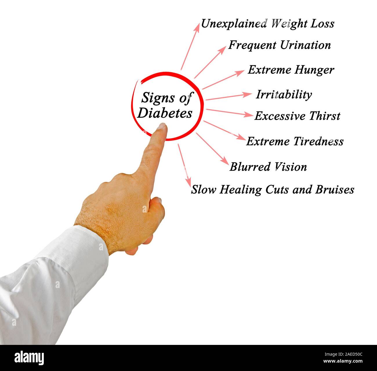 Signs of diabetes stock photo alamy
