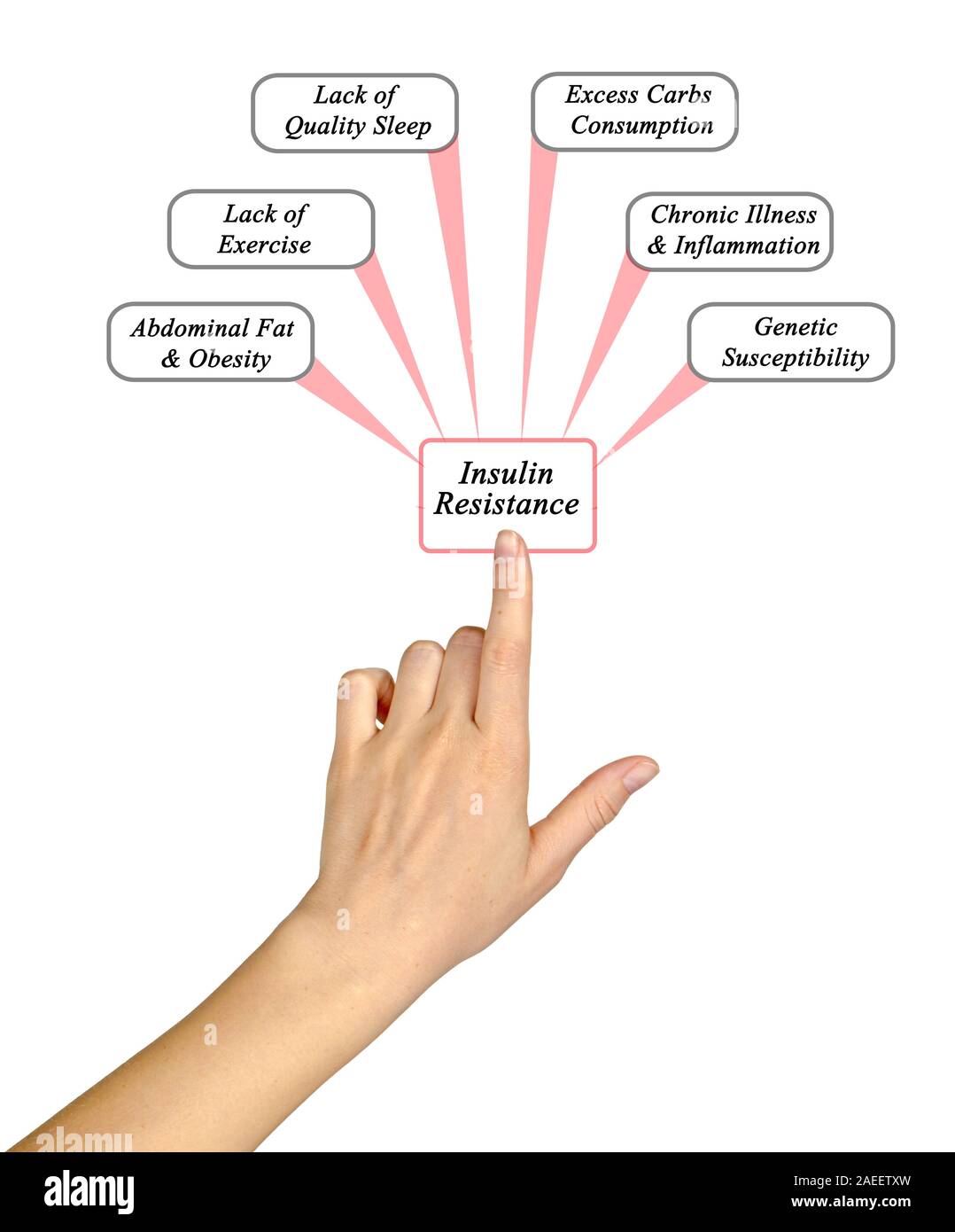 Causes of Insulin Resistance Stock Photo - Alamy - Causes Insulin Release
