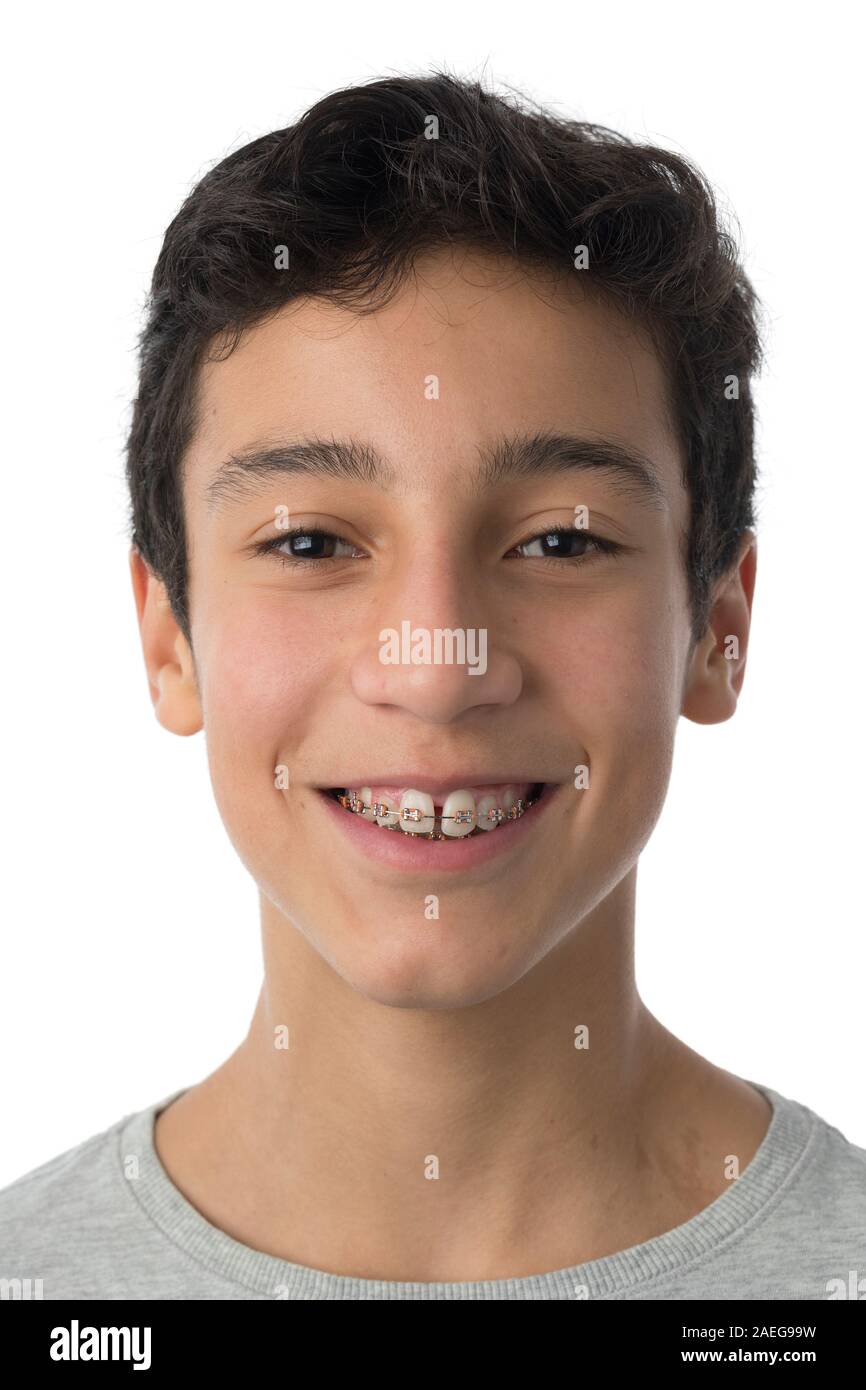 Portrait of a happy teenage boy with braces Stock Photo
