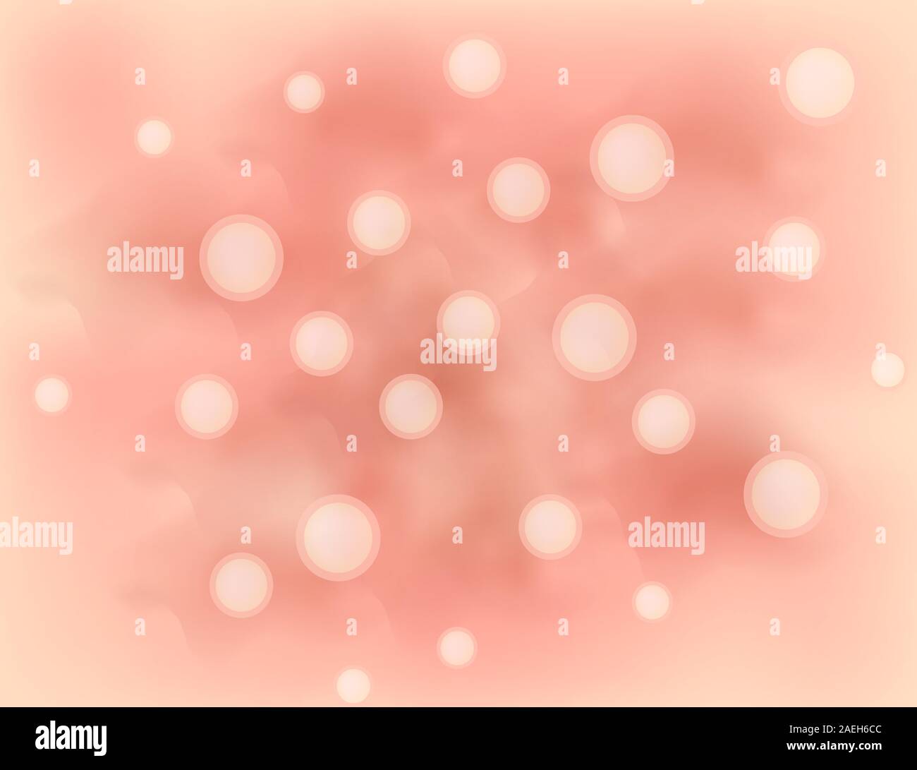 Papules on the skin. Acne. Pimples on the skin background. Acne on the