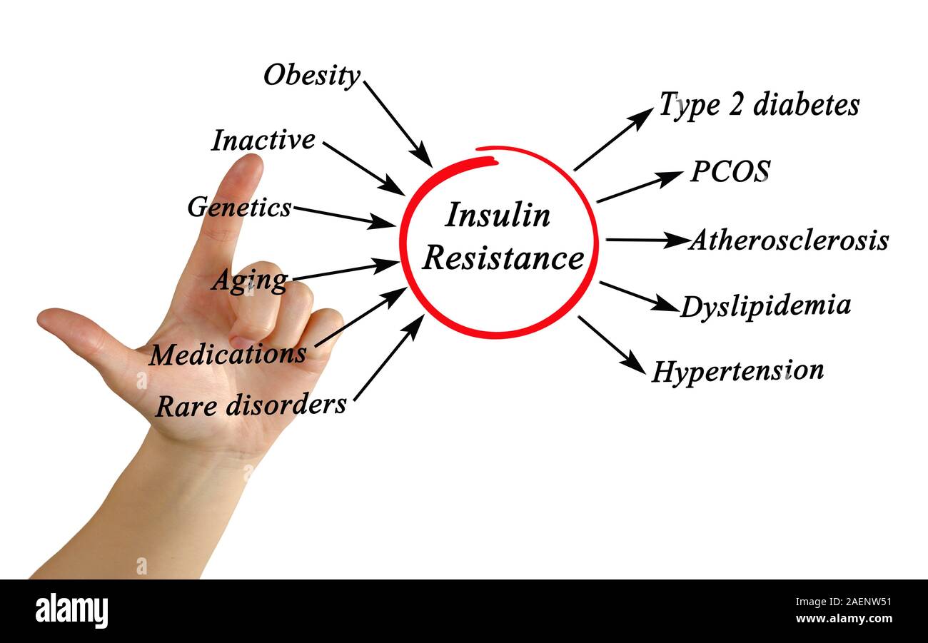Insulin disorders hires stock photography and images Alamy