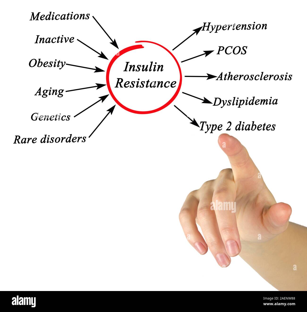 Causes of Insulin Resistance Stock Photo Alamy