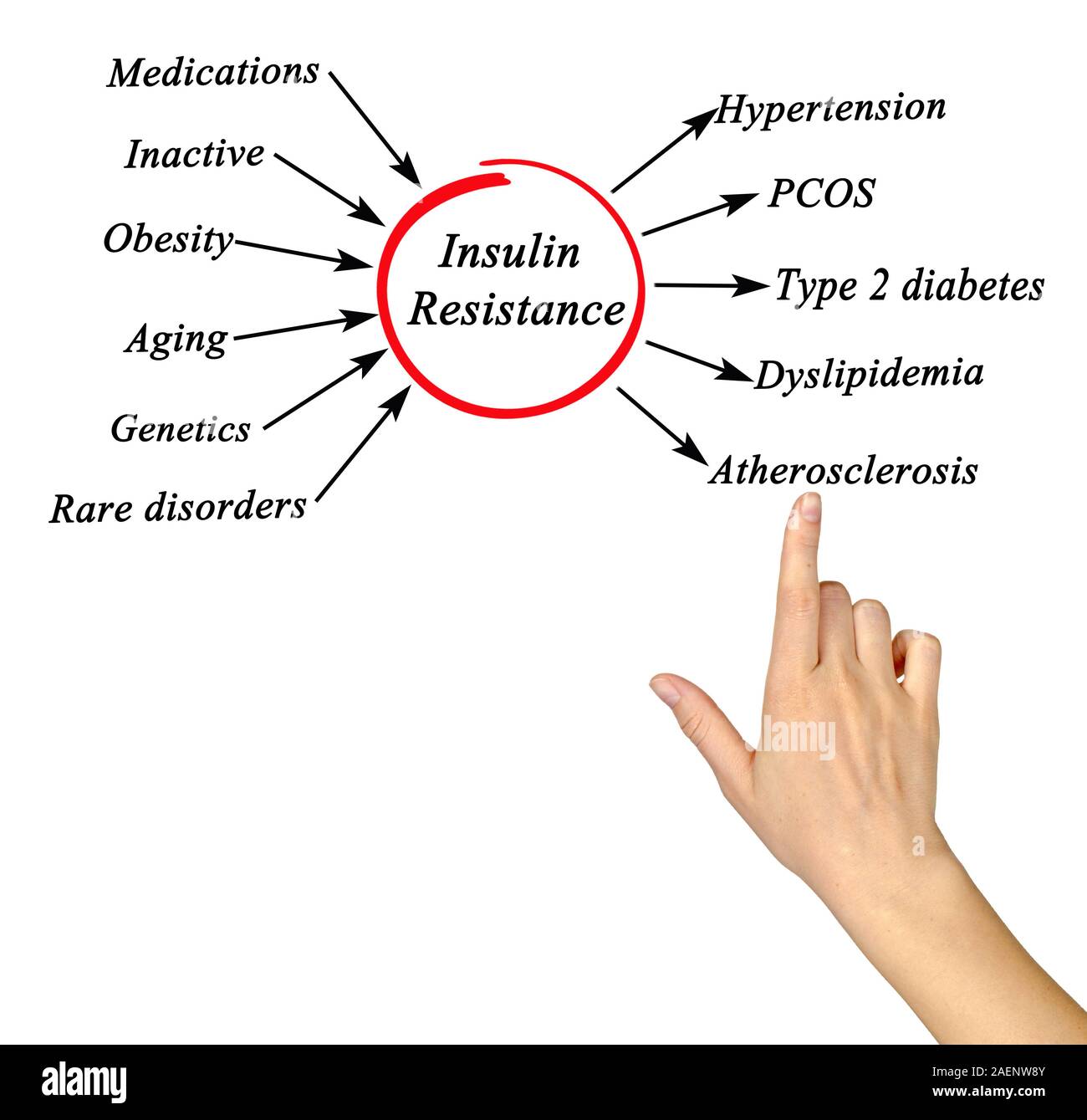 Causes And Effects Of Insulin Resistance Stock Photo Alamy Causes And Effects Of Insulin Resistance Stock Photo Alamy