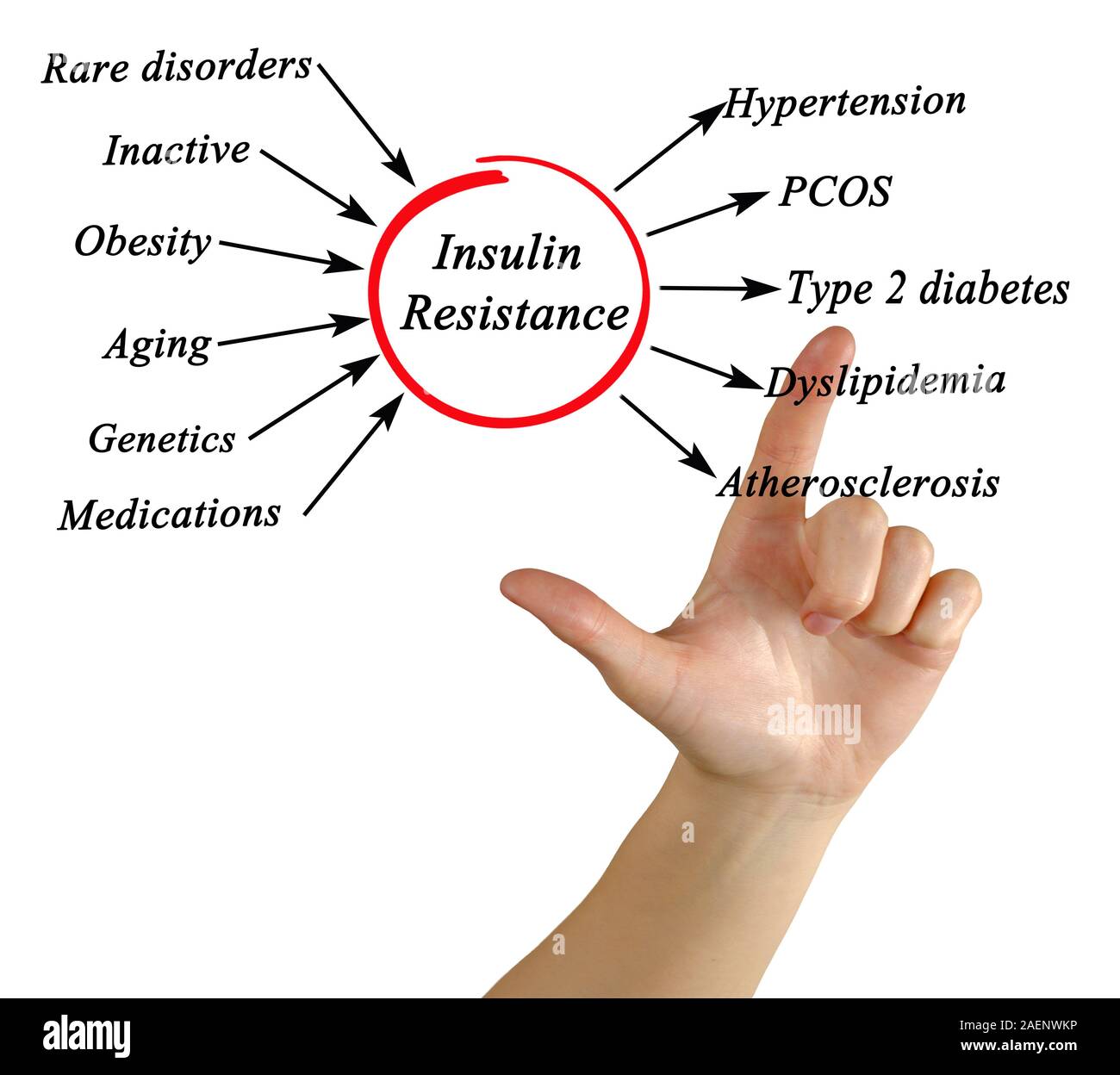 Causes and effects of Insulin Resistance Stock Photo Alamy