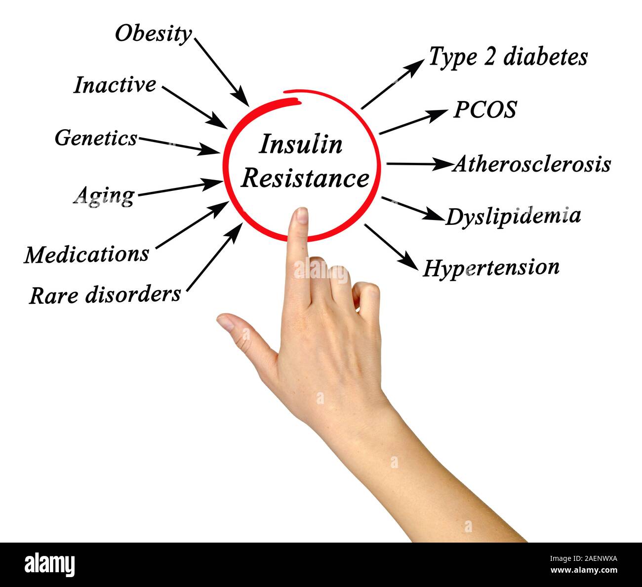 Insulin disorders hires stock photography and images Alamy