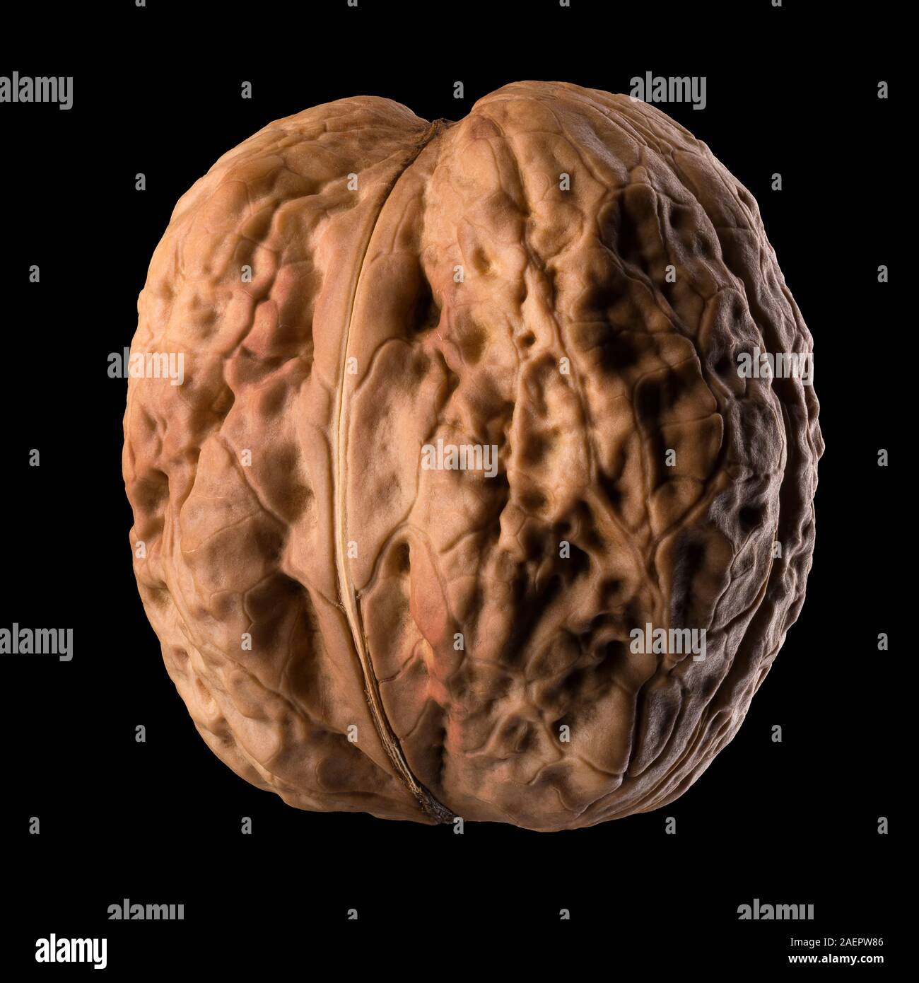 Walnut On Radiograph Macro photo of whole walnut isolated on a black background with ...