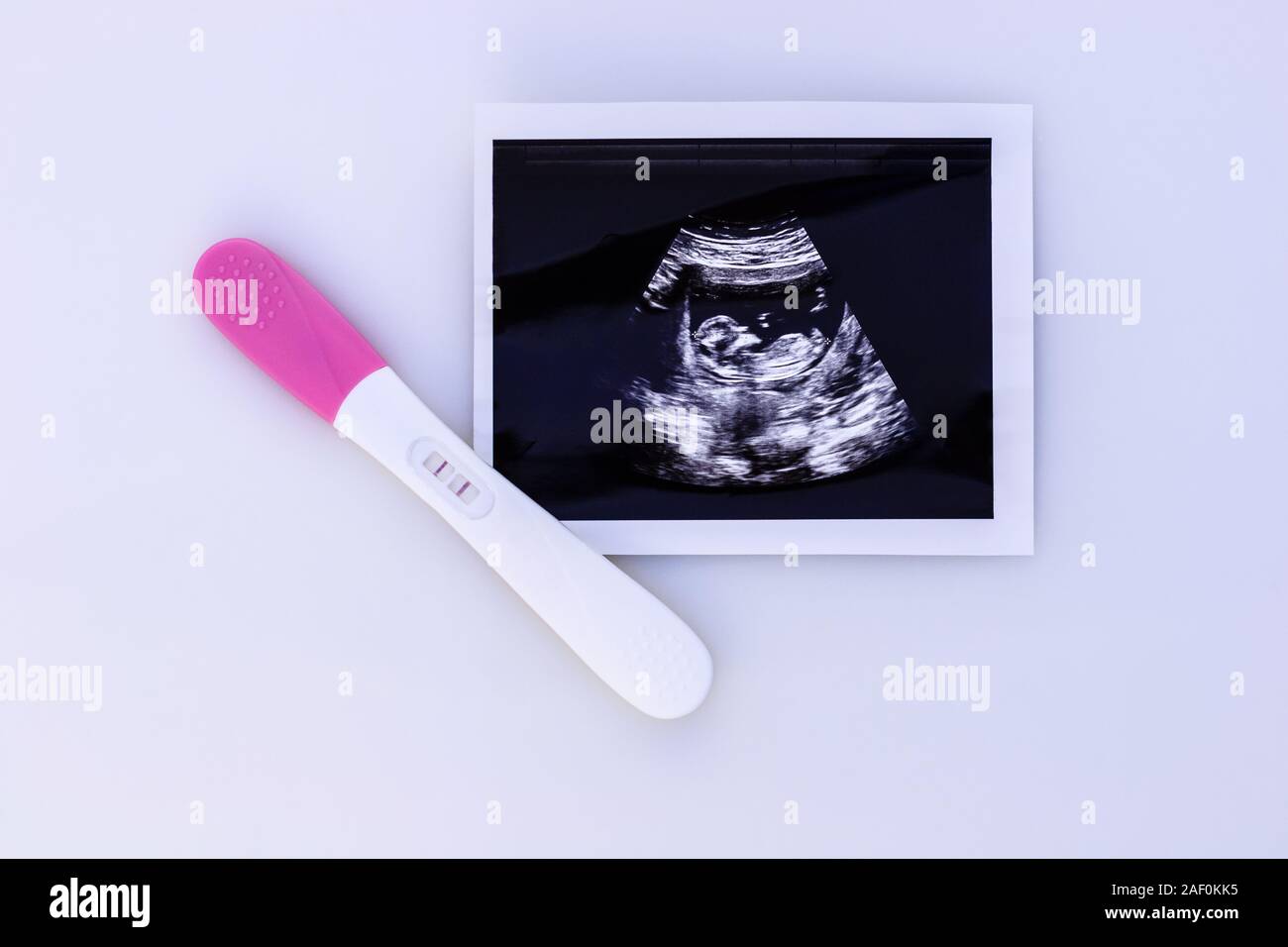 Pregnancy test showing a positive result and ultrasound image isolated on white background. Stock Photo