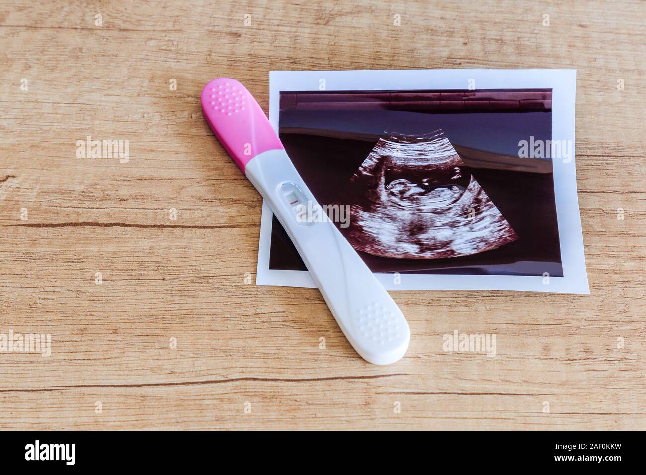 Pregnancy test showing a positive result and ultrasound image isolated on wooden background. Stock Photo