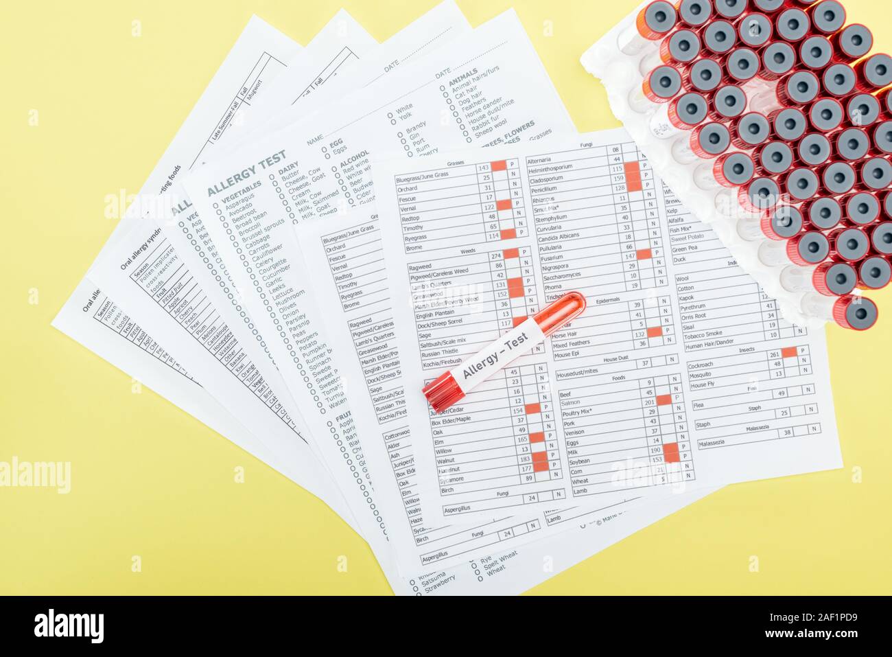top view of allergy test results near test tubes with allergy test