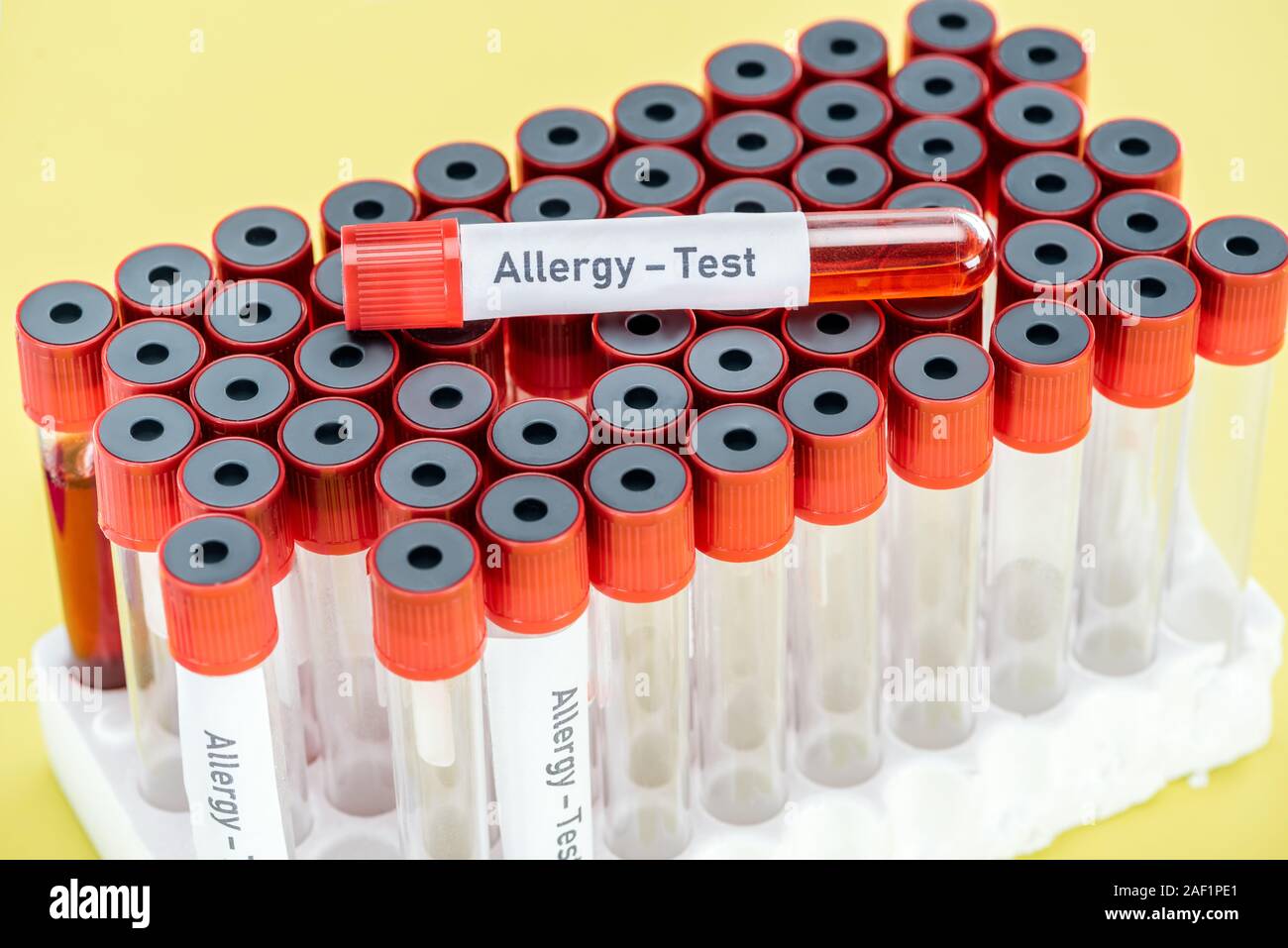 allergy test sample with allergy test inscription on empty test tubes